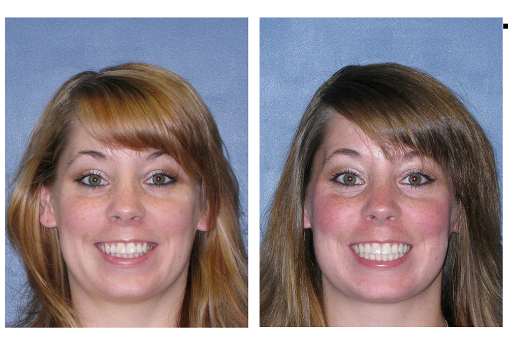Healthy Smiles of Scappoose