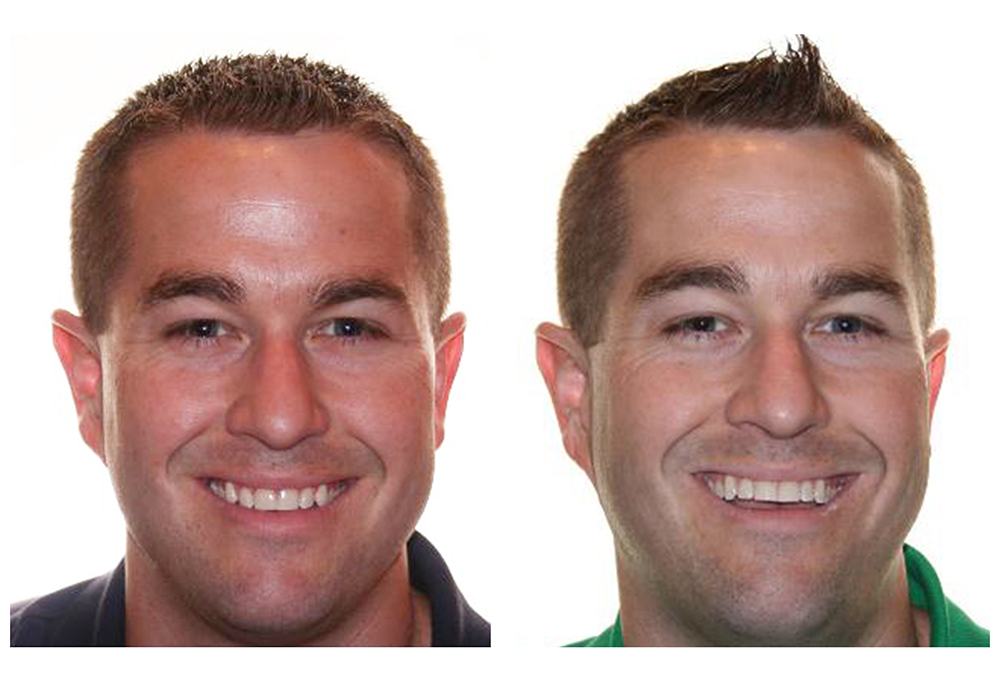 Healthy Smiles of Scappoose