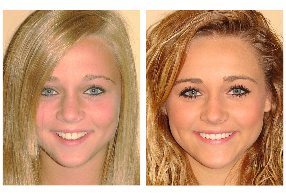 Healthy Smiles of Scappoose