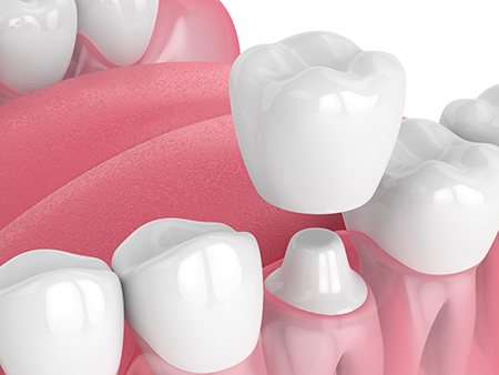 Healthy Smiles of Scappoose