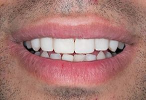 Healthy Smiles of Scappoose | CBCT, Panoramic Imaging and Periodontal Treatment