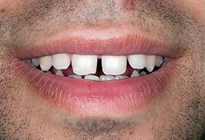 Healthy Smiles of Scappoose | CBCT, Emergency Treatment and Teeth Whitening