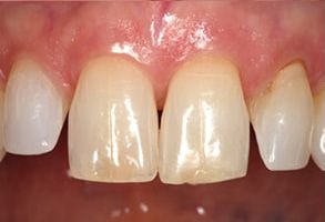 Healthy Smiles of Scappoose | Periodontal Treatment, Digital Impressions and Panoramic Imaging